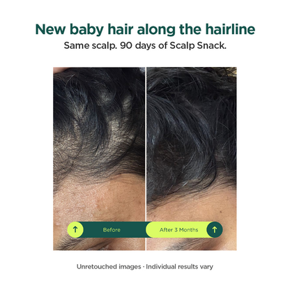 Scalp Snack