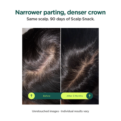 Scalp Snack