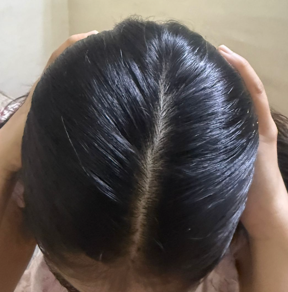 After